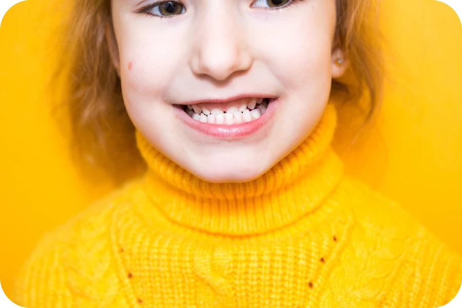 dents definitives orthodontie la native Orthodontie fonctionnelle La Native | Orthodontie & Pédodontie