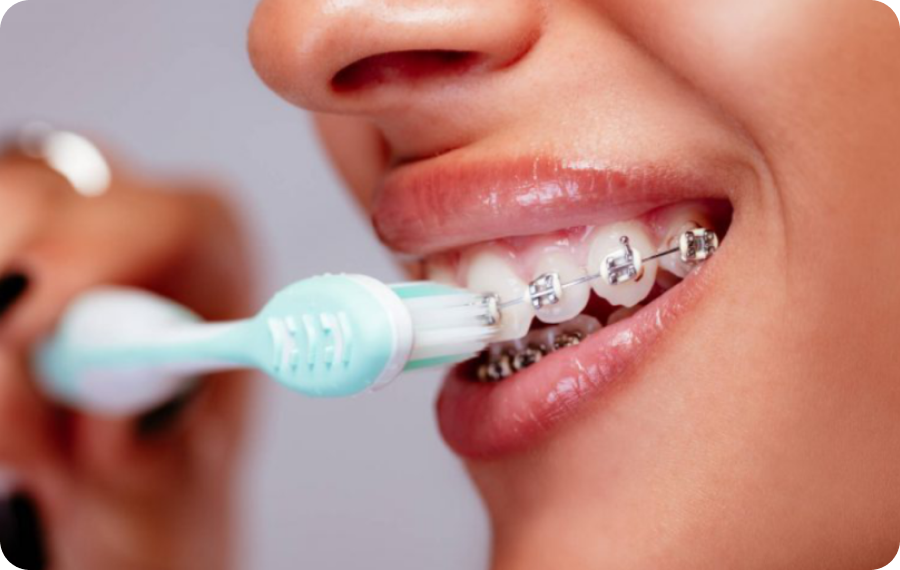 orthodontiste orthodontie avancee aix Sensibilité dentaire chez l’enfant La Native | Orthodontie & Pédodontie