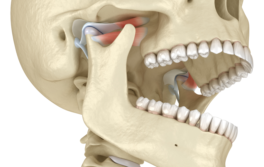 orthodontiste orthodontie avancee pont de larc Problème de mastication La Native | Orthodontie & Pédodontie