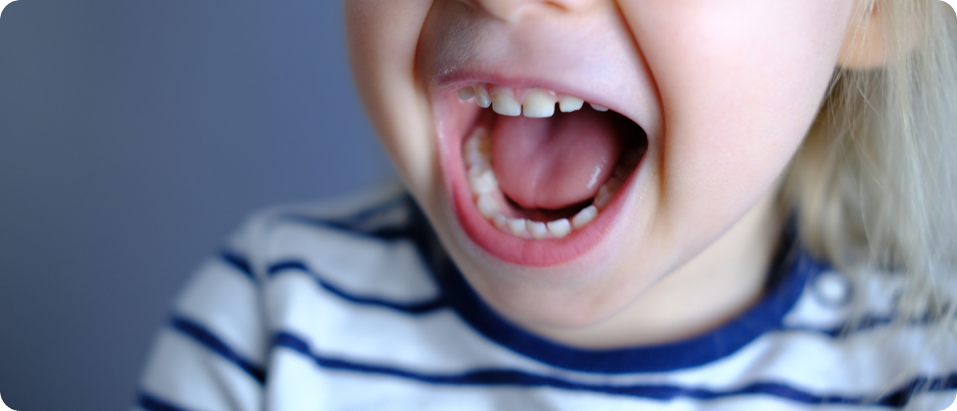 orthodontiste suivi adultes Problème d’élocution La Native | Orthodontie & Pédodontie