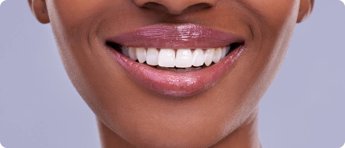 sourire pathologies problemes esthetiques dentaires la native Problèmes esthétiques dentaires La Native | Orthodontie & Pédodontie