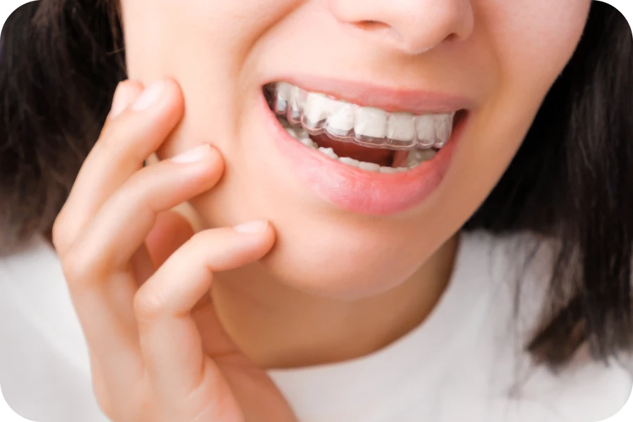 traitement diasteme la native Espace entre les dents La Native | Orthodontie & Pédodontie
