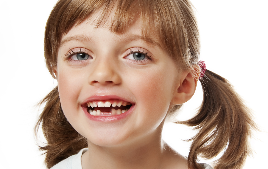 une fille pathologies prevention des problemes dentaires la native Prévention des problèmes dentaires La Native | Orthodontie & Pédodontie