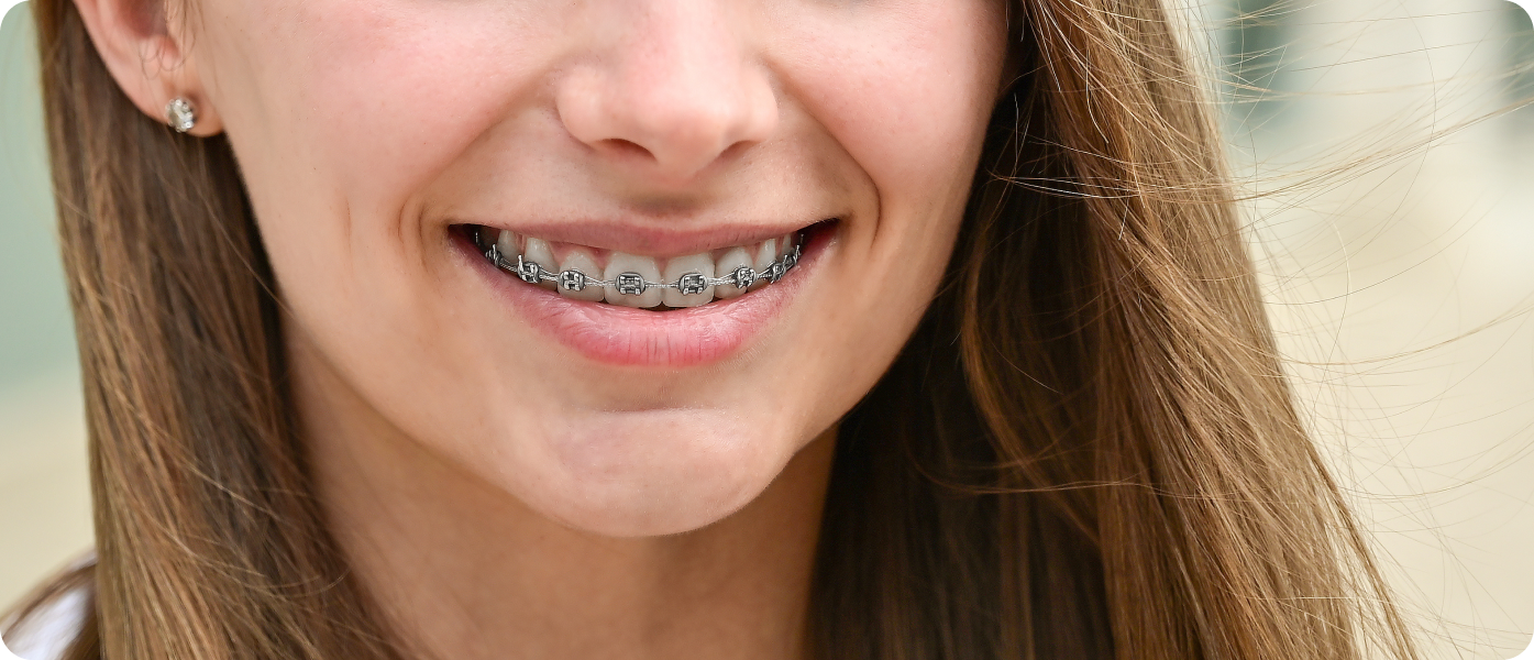 une fille pathologies sensibilite dentaire chez lenfant la native Sensibilité dentaire chez l’enfant La Native | Orthodontie & Pédodontie
