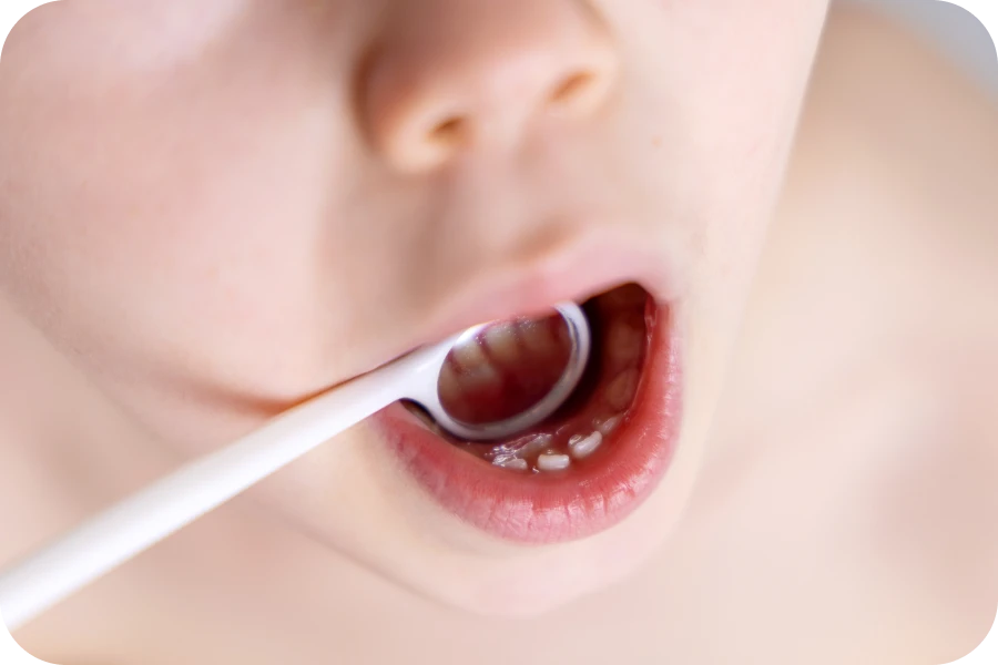 orthodontiste orthodontie precoce Dentiste enfant à Luynes La Native | Orthodontie & Pédodontie